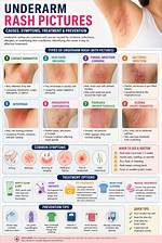 6 Causes of Underarm Rashes and How to Avoid Irritating Your Armpits