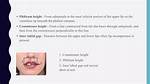 A Comprehensive Guide to Enhancing Lip Height: Say Goodbye to Shameless Lips