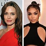 A Guide to Enhancing Your Pout
