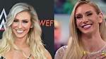 Charlotte Flair Before and After Surgery Pics, Age Wiki and Family |