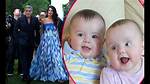 Clooney's Child: Navigating Down's Syndrome