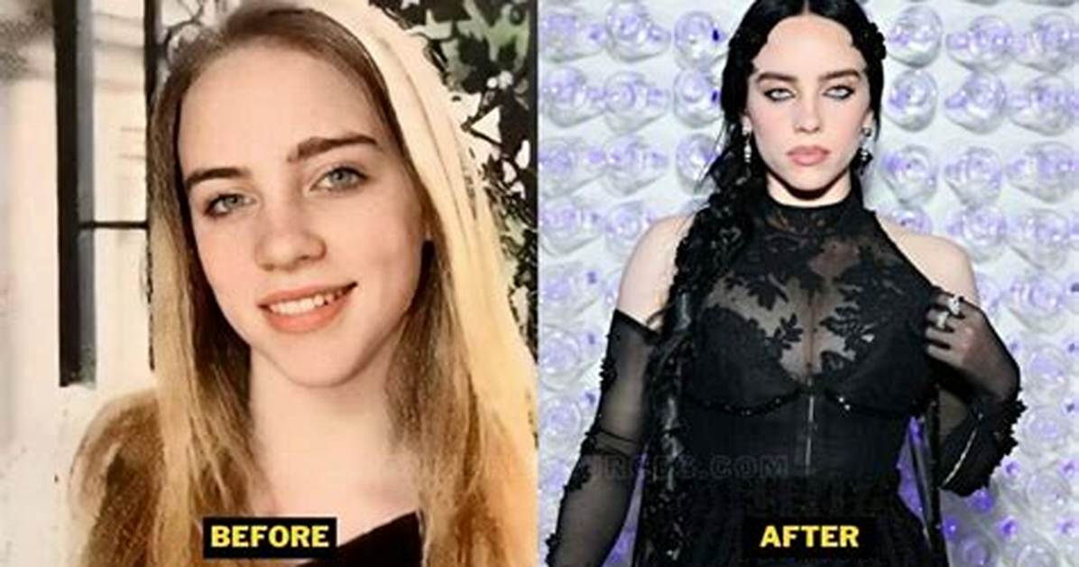 Did Billie Eilish Get a Boob Job?