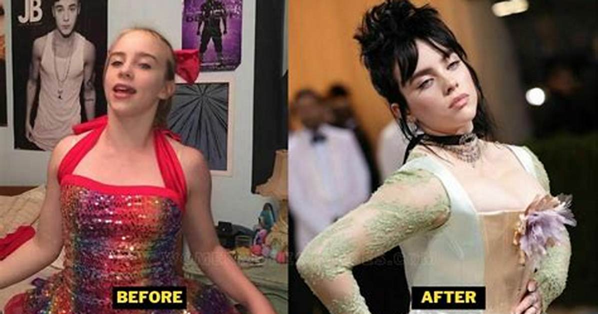 Did Billie Eilish Have Breast Reduction? Exploring the Truth Behind the Rumors