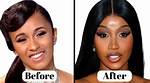 Did Yodit Yemane Have Plastic Surgery? See Her Before and After Pictures