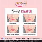 Dimples of Delight: Discovering the Biggest Dimples in the World