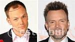 Does Joel Mchale Have Hair Plugs? His Hairline Is Telling