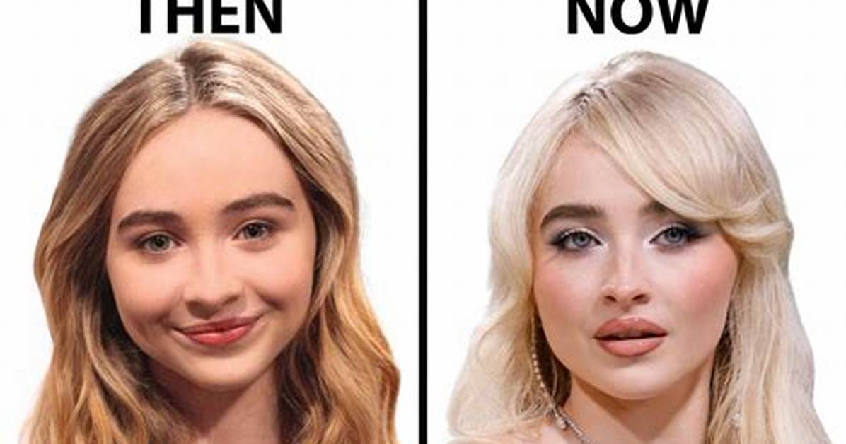 Does Sabrina Carpenter's Face Hint at the Use of Fillers?