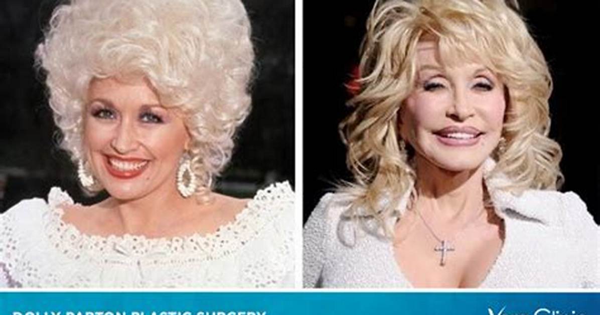 Dolly Partons Plastic Surgery Chronicles: a Journey of Beauty and Bravery