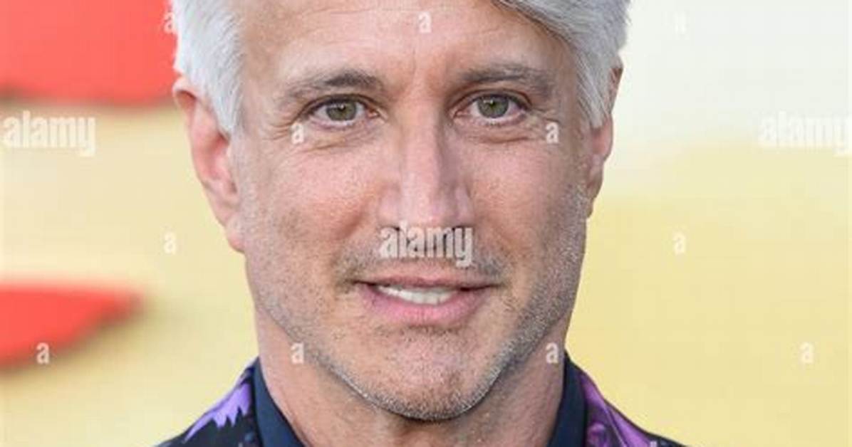 Exploring the Charismatic World of Bronson Pinchot as Serge