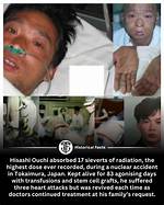 Exploring the Impact of Ouchi Radiation Pictures