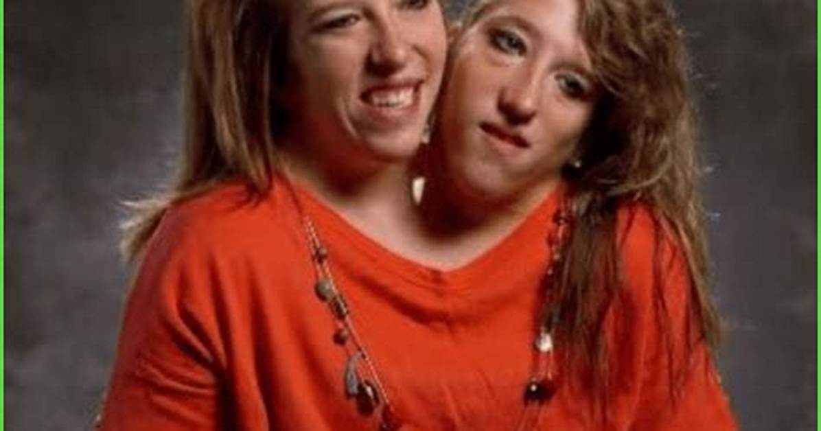 Exploring the Lives of Abby and Brittany: Are They Still Alive?