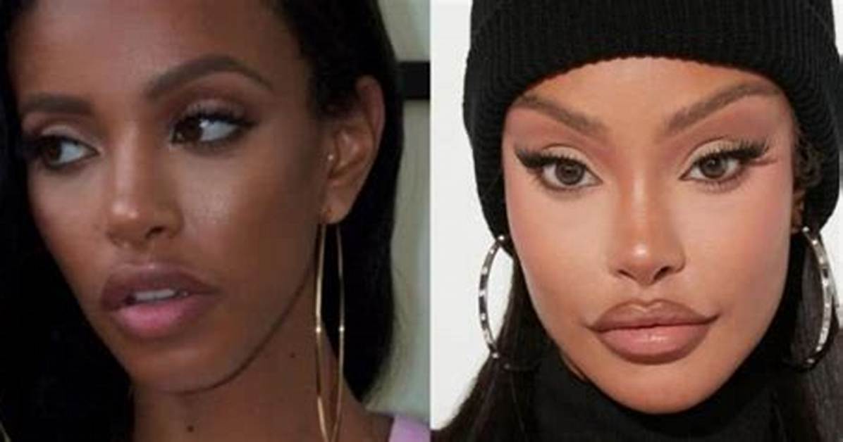 How Jodie Joe Changed After Her Surgery?