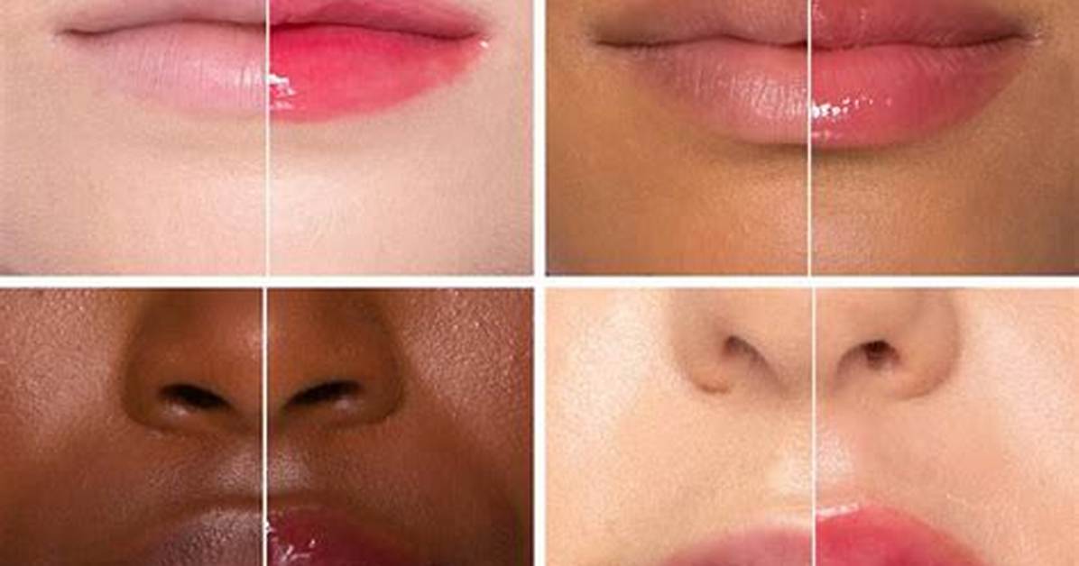 How Long Does Two-Faced Lip Injections Really Last? Find out Here
