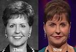 Is Joyce Meyer Hiding a Face Surgery? Uncovering the Truth