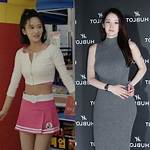 Jeon Jong-Seo Plastic Surgery Before and After- Who Is Her Boyfriend Lee Chung-Hyun? ·
