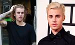 Justin Bieber's Hair Transformation: the Journey of His Hair Transplant