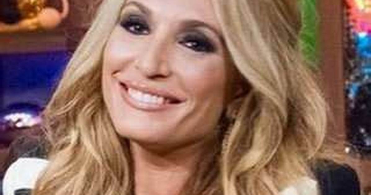 Kate Chastain Might Have Gotten More Plastic Surgeries Than She Admits