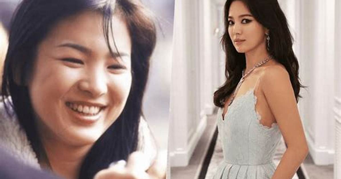 Korean Transformations: the Fascinating World of Before and After Plastic Surgery