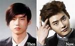 Lee Jong Suk | Before Plastic Surgery? Wrong with His Face? ·
