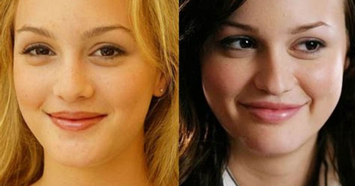 Leighton Meester Plastic Surgery Before and After ·