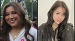 Moira Dela Torre | Before and After Surgery and New Look