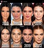 Plastic Surgery Before and After ·