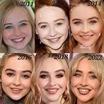 Proof of Sabrina Carpenter's Lip Injections: the Unseen Truth