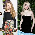 Sabrina Carpenter: a Journey Through Change - Before Plastic Surgery