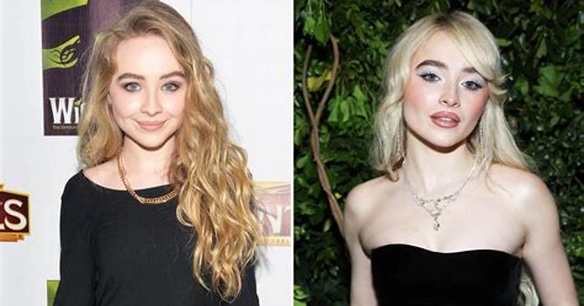 Sabrina Carpenter's Natural Beauty: Before Lip Filler Transformation