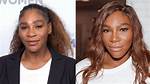 Serena Williams Plastic Surgery: Unveiling the Truth Behind the Rumors