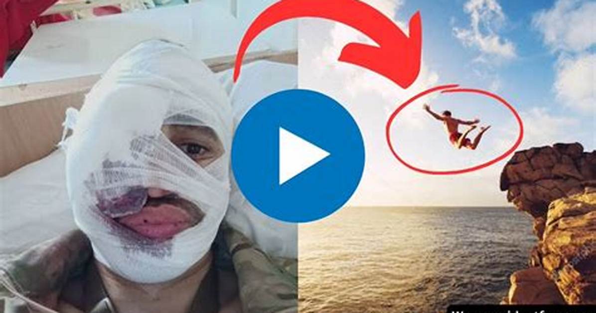 Split Face Diving Accident: the Shocking Story of a Teenagers Near-Fatal Injury