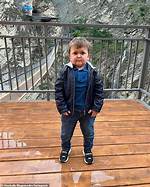 The Mystery of Hasbulla's Rare Medical Condition