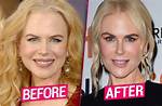 Transformations and Revelations: Nicole Kidman After Plastic Surgery