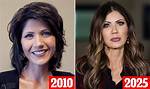 Transformations of Kristi Noem: a Look at Her Before and After Cosmetic Surgery