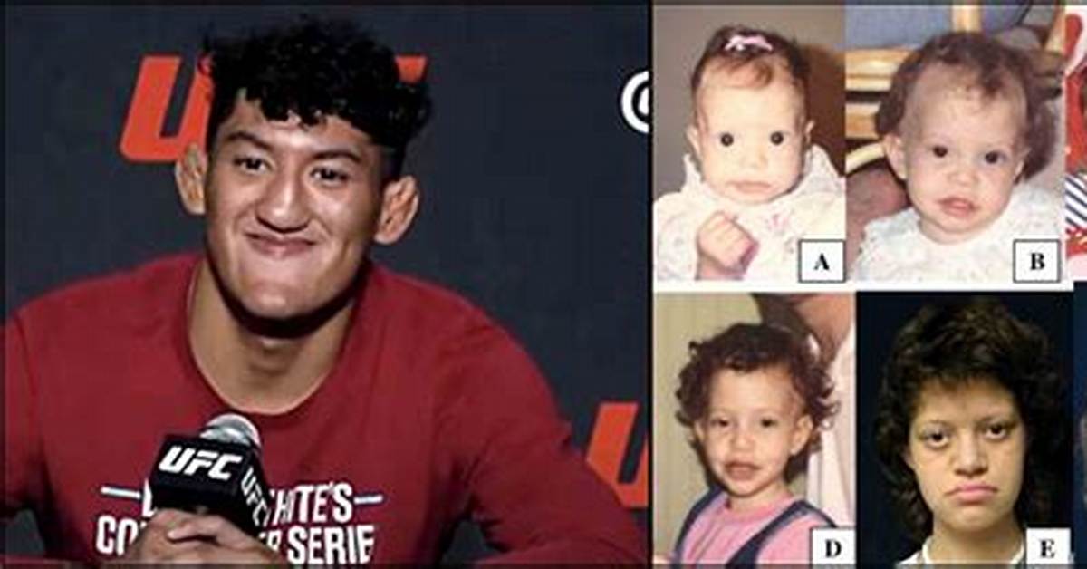 Understanding Raul Rosas Jr Condition: a Deep Dive