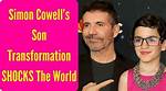 Understanding the Health Challenges of Simon Cowell's Son