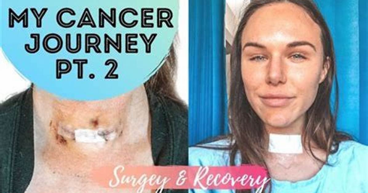 Unraveling the Journey of Joyce Vance's Thyroid Surgery
