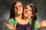 Unraveling the Mystery: Are Conjoined Twins Abby and Brittany Dead?
