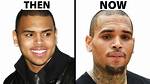 Unraveling the Truth: Does Chris Brown Have Herpes?