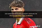 Unveiling Garnacho: the Truth Behind His Face Surgery