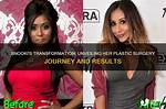 Unveiling Her Bottom Surgery Journey