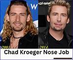 Unveiling the Life of Chad Kroeger: a Journey Through His Date of Birth and Beyond