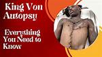 Unveiling the Mystery: King Von's Autopsy and Its Impact on His Legacy