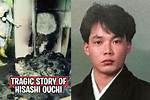 Unveiling the Story Behind Hisashi Ouchi's Face: a Tale of Resilience and Suffering