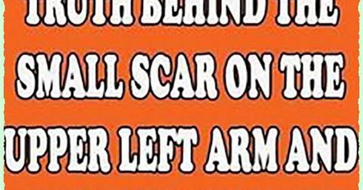Unveiling the Truth Behind the Scar