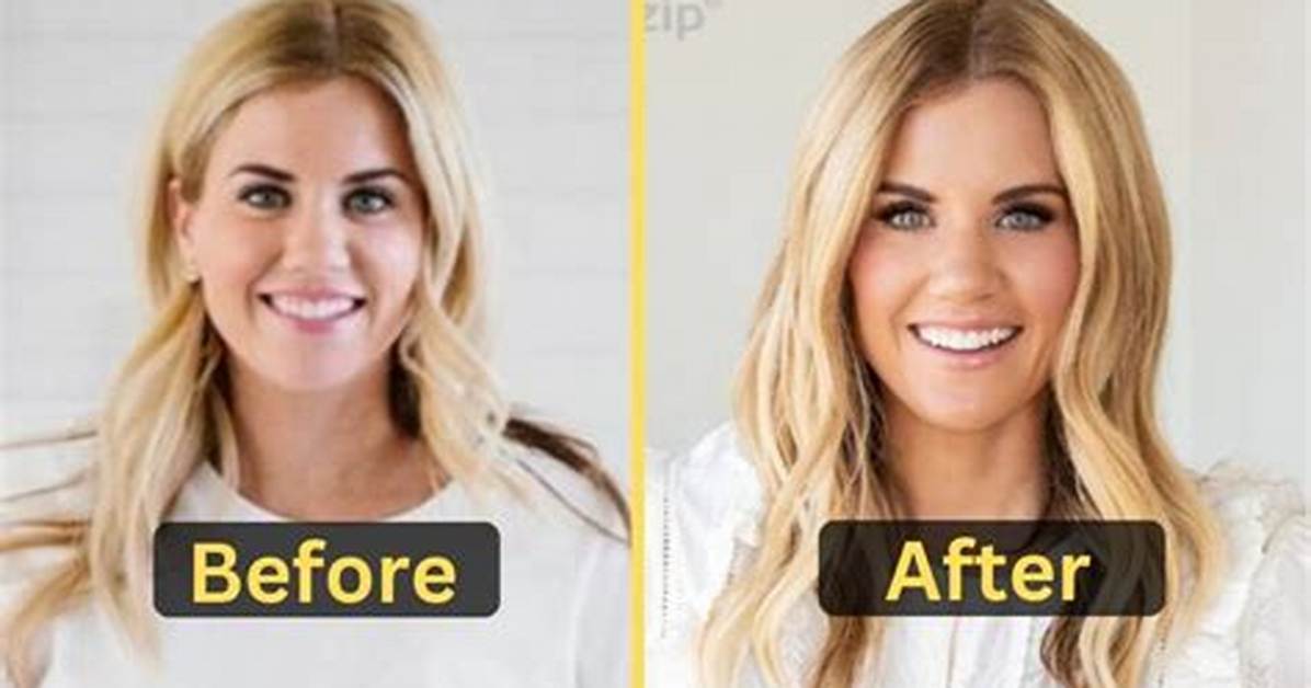 What Happened to Shea Mcgee Teeth? Did the Dream Home Makeover Cast Have Surgery in Her Mouth