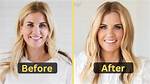 What Happened to Shea Mcgee Teeth? Did the Dream Home Makeover Cast Have Surgery in Her Mouth