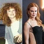 When Did Nicole Kidman Get Plastic Surgery? Uncovering the Truth